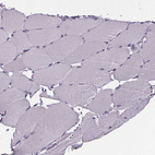 Immunohistochemical staining of human skeletal muscle shows no positivity in myocytes as expected.