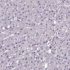 Anti-SPEF2 Antibody