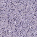 Anti-SPEF2 Antibody