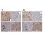 Anti-NBEA Antibody