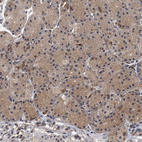 Anti-NBEA Antibody