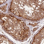 Anti-MMP15 Antibody