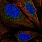 Anti-SARAF Antibody