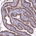 Anti-UBL7 Antibody