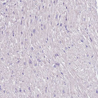 Immunohistochemical staining of human heart muscle shows no positivity in cardiomyocytes.