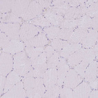 Immunohistochemical staining of human skeletal muscle shows no positivity in myocytes.