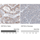 Anti-CEP192 Antibody