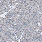 Anti-CEP192 Antibody