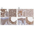 Anti-PSMD9 Antibody