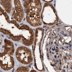 Anti-PSMD9 Antibody