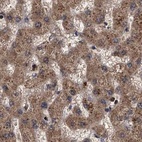 Anti-PSMD9 Antibody