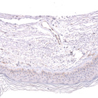 Anti-FERMT2 Antibody