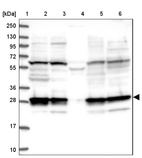 Anti-PSMD9 Antibody