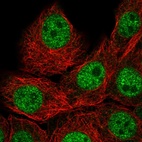 Anti-IAH1 Antibody