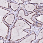 Anti-BTBD16 Antibody