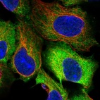 Anti-EEF2 Antibody