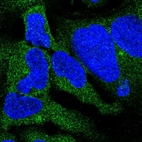 Anti-DYNC1I2 Antibody