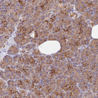 Anti-WDFY4 Antibody