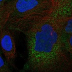 Anti-C11orf16 Antibody