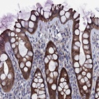 Anti-BCL2L14 Antibody