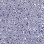 Anti-BCL2L14 Antibody