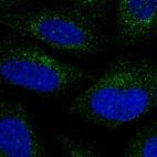 Anti-BCL2L14 Antibody