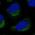 Anti-LNX2 Antibody