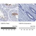 Anti-CABYR Antibody