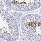 Anti-CABYR Antibody