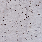 Anti-ZMIZ2 Antibody