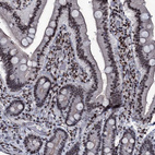 Anti-ZMIZ2 Antibody