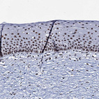 Anti-ZMIZ2 Antibody