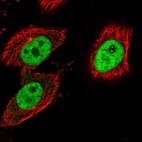 Anti-LEO1 Antibody