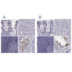 Anti-FAM71B Antibody