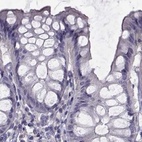 Anti-FAM71B Antibody