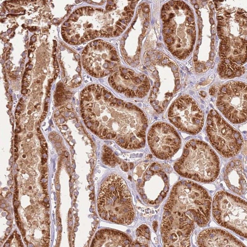 Anti-LRRC28 Antibody