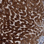 Anti-ZC3H7A Antibody