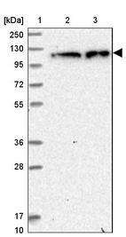 Anti-ZC3H7A Antibody