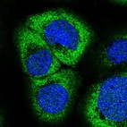 Anti-ZC3H7A Antibody