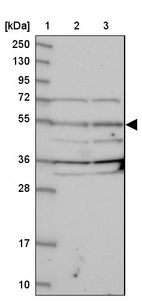 Anti-NARFL Antibody