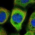 Anti-NARFL Antibody