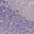 Anti-XKR7 Antibody