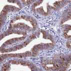 Anti-XKR7 Antibody