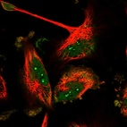 Immunofluorescent staining of human cell line U-251 MG shows localization to nucleus & nucleoli.