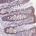 Anti-MGME1 Antibody