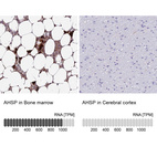 Anti-AHSP Antibody