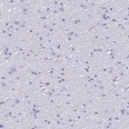 Anti-AHSP Antibody