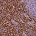 Anti-PSTPIP2 Antibody