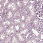 Anti-PSTPIP2 Antibody