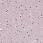 Anti-PSTPIP2 Antibody